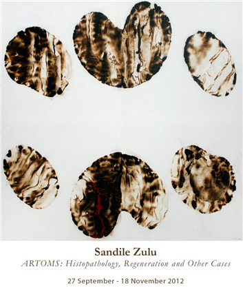 ARTOMS: Histopathology, Regeneration and Other Cases