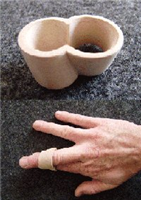 Prototype